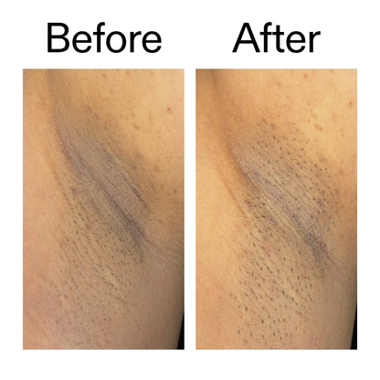 Nexura Glycolic Acid Body Exfoliant Stick