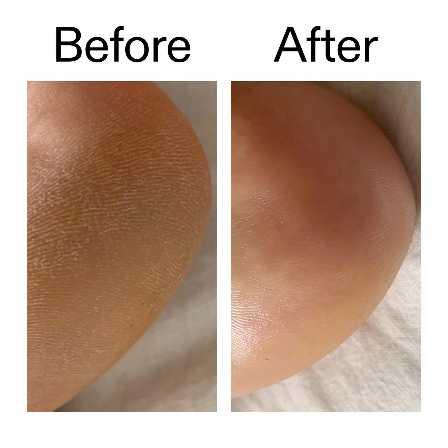 Nexura Glycolic Acid Body Exfoliant Stick
