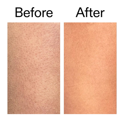 Nexura Glycolic Acid Body Exfoliant Stick