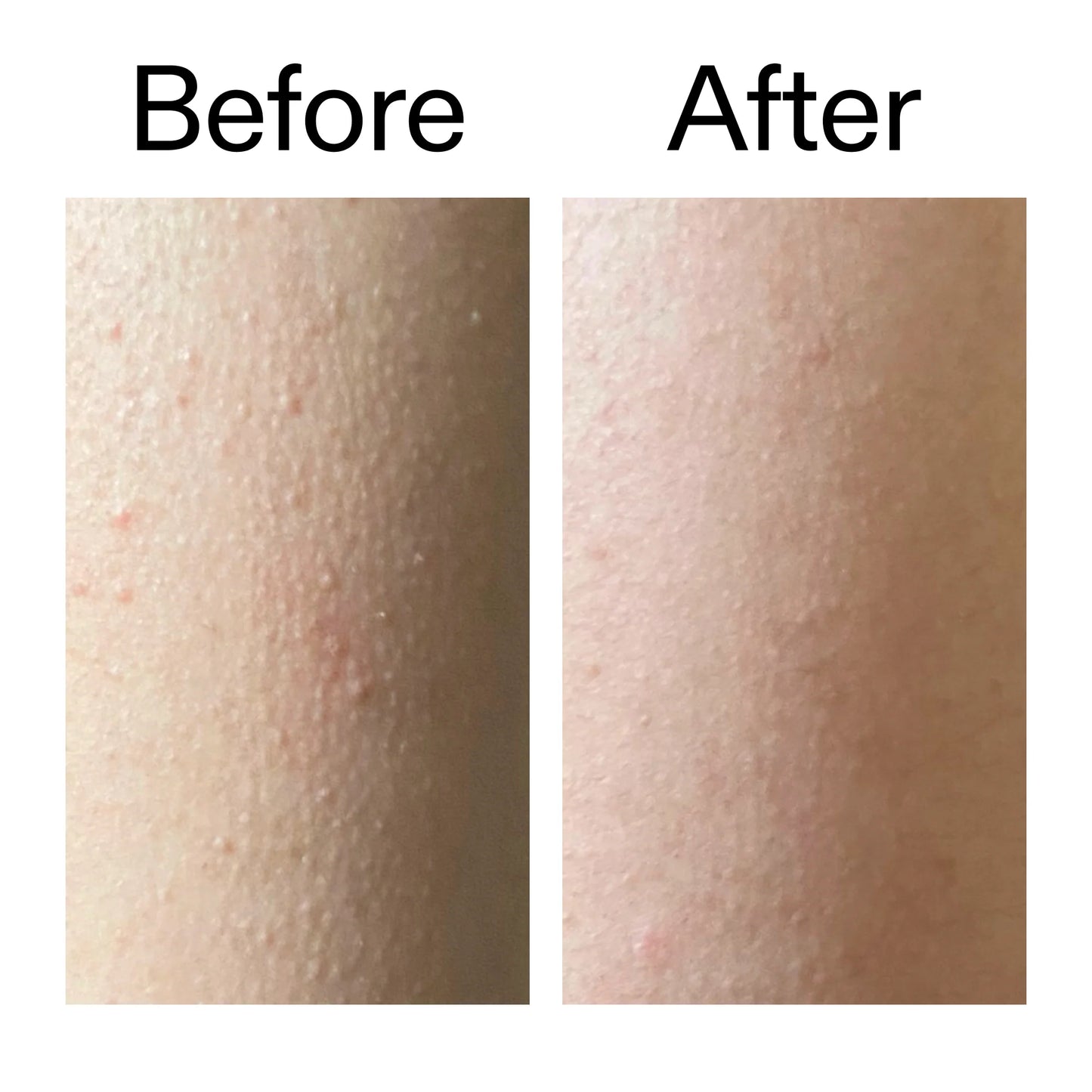 Nexura Glycolic Acid Body Exfoliant Stick