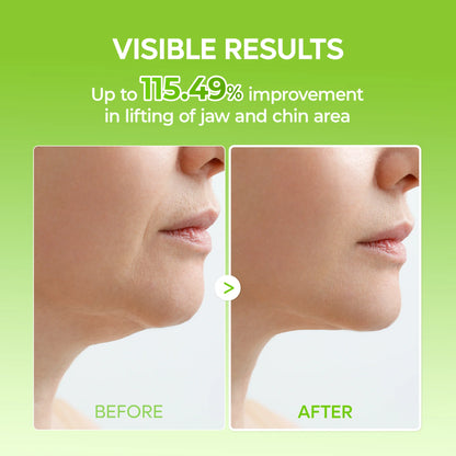 V-Lift Jaw Band